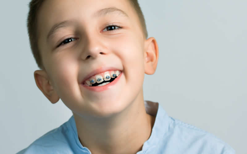 Children’s Orthodontic Treatment